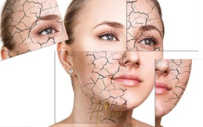آرایش پوست خشک