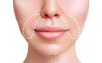 رفع خط خنده با میکاپ