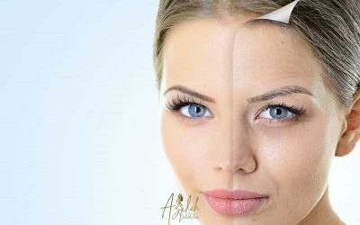 آرایش پوست حساس