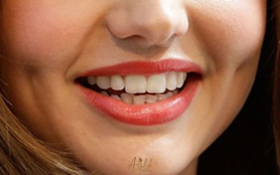 چال گونه با آرایش